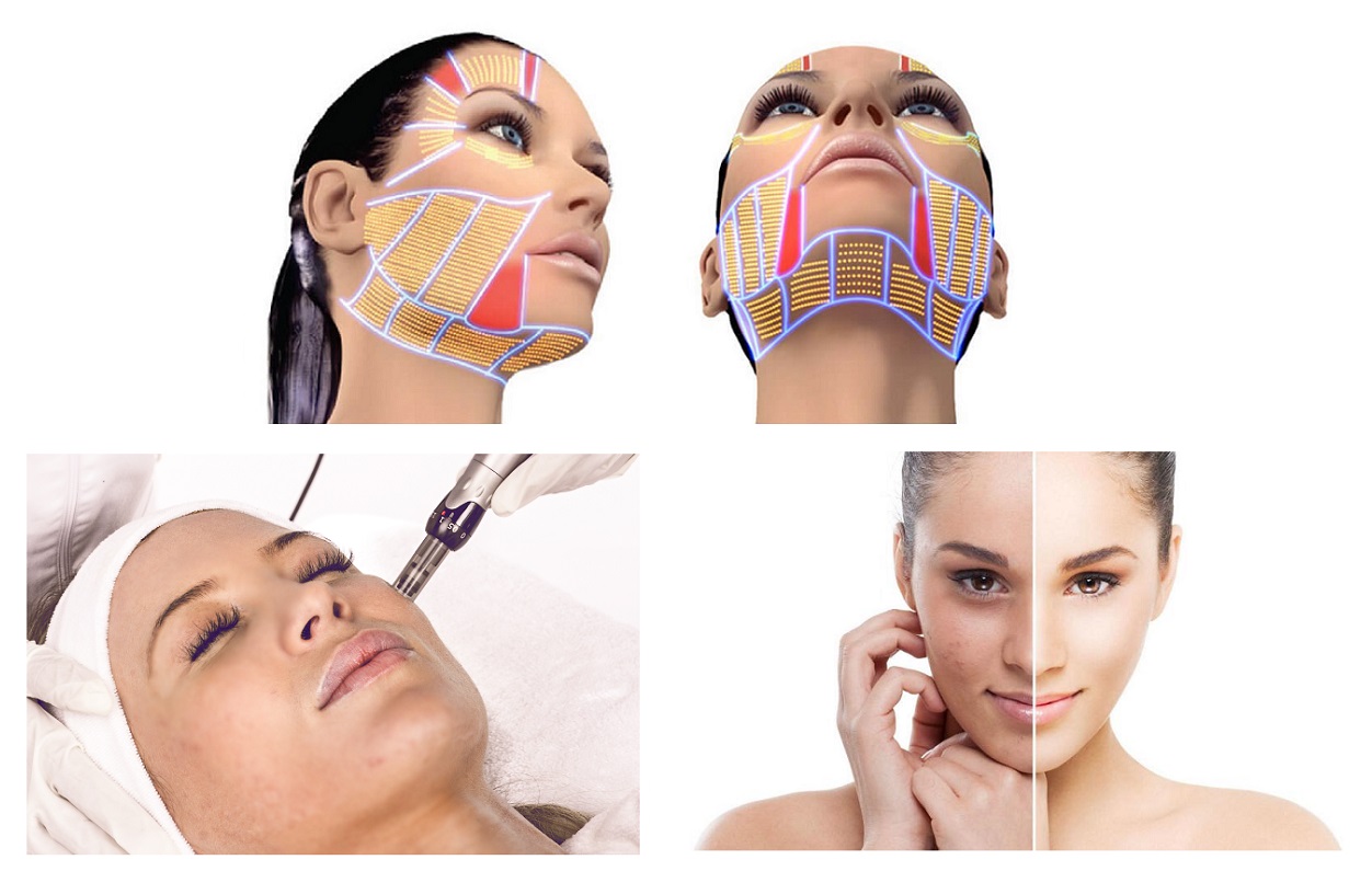 Tratamientos de cirugía estética facial en Badajoz